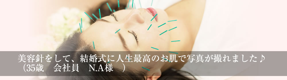 稚乃針灸整骨院は美容鍼灸 美顔鍼 美容整体 骨盤矯正 耳つぼ ダイエット等のエステメニューが豊富です 大阪府茨木市 稚乃針灸整骨院は美容鍼灸 美顔鍼 美容整体 骨盤矯正 耳つぼ ダイエット等のエステメニューが豊富です 大阪府茨木市